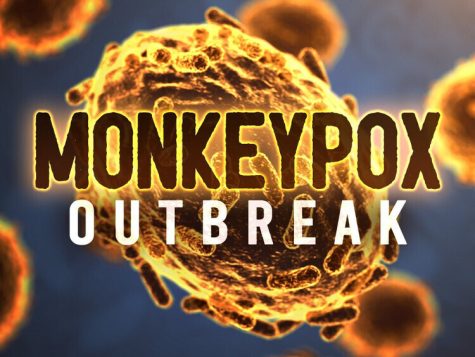 Monkeypox: Debunking Myths and Misconceptions